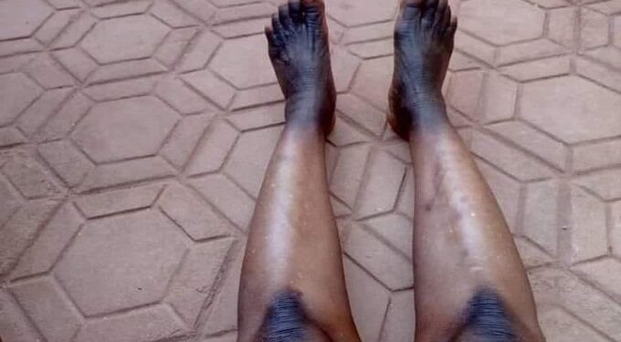 Dépigmentation : Que cherchent les hommes dedans ?