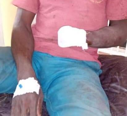 Bénin : Conflit entre éleveurs et agriculteurs, un cultivateur s’en sort avec un bras en moins