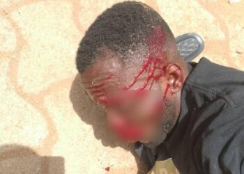 Bénin : Un homme blessé pour non port de casque par la police admis aux urgences (Les détails)