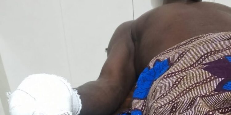 Bénin : Une altercation entre agriculteurs et éleveurs vire au drame (les détails)